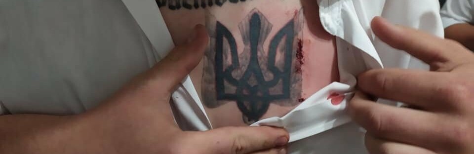 У Хмельницькій області кандидата у нардепи вдарили ножем у груди